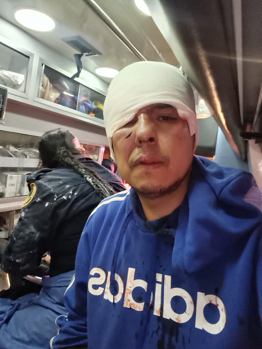 🚨 #ÚLTIMAHORA| Nicolás Corte (<a href="/Nickorte/">Nicolás Corte 🇲🇽</a>), fotógrafo de #PublimetroMX, es agredido durante la marcha del #2DeOctubre

Por el momento paramédicos lo atienden en el lugar

#2DeOctubreNoSeOlvida
