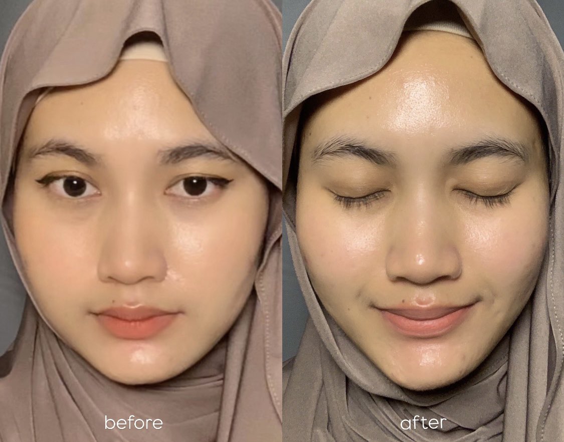 Acne prone skin &amp; oily skin wajib punya facewash ini sihh 😆

COSRX — Salicylic Acid Daily Gentle Cleanser ✨