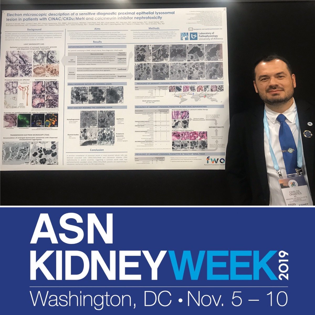 nefrorantes's tweet image. #CINAC #Timeline 2019 @ISNkidneycare #Kidneywk @ASNKidney @Kidney_Int pubmed.ncbi.nlm.nih.gov/31892415/