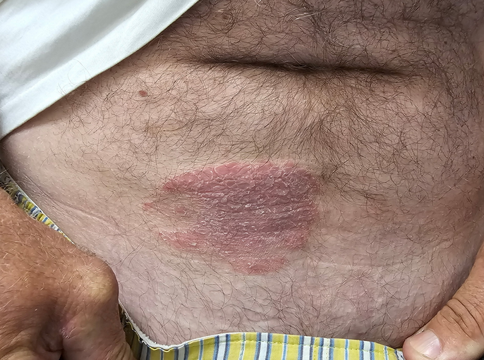 EM case challenge:
Itchy belly rash
erpocketbooks.com/p2/