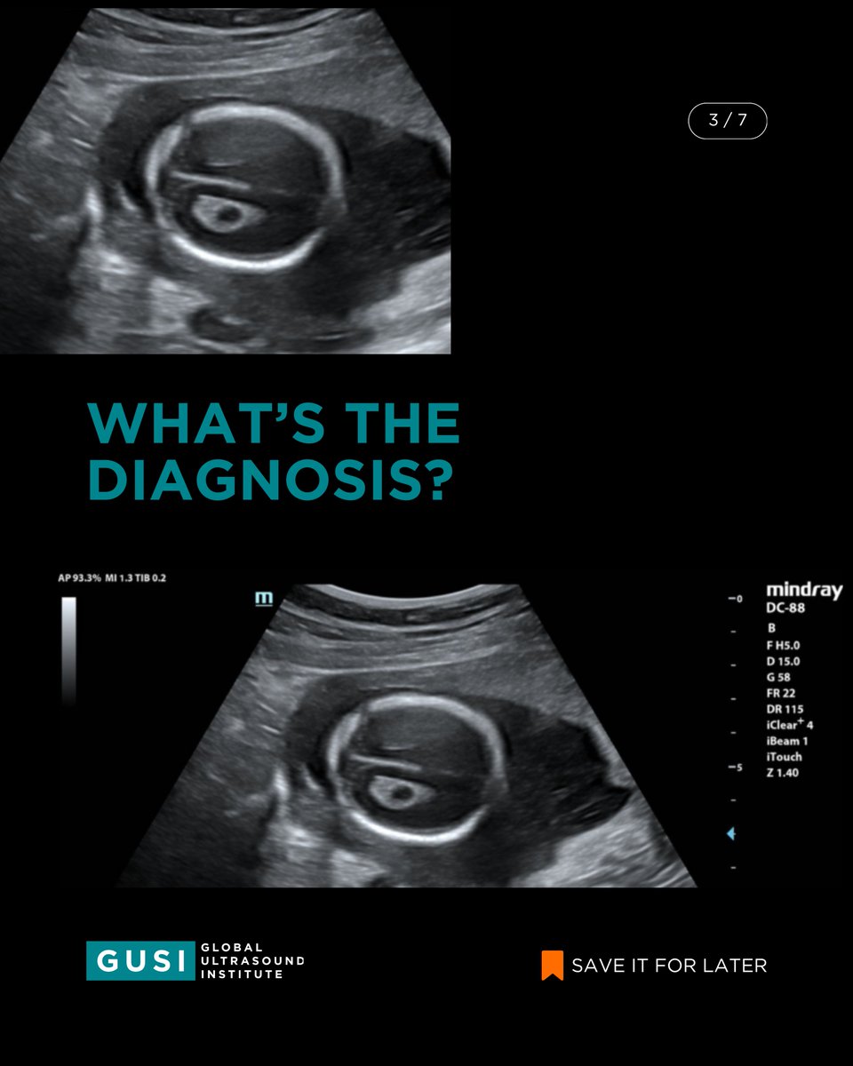 Global Ultrasound Institute tweet media