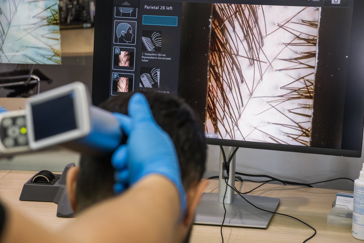 Diagnosis is the first and most essential step in treating hair loss.
At DHI, our DSA diagnostic system examines scalp and hair health in detail, uncovering the root causes and creating a tailor-made treatment plan for you.
#HairLossDiagnosis #DHI #HairHealth #RevealTheCauses