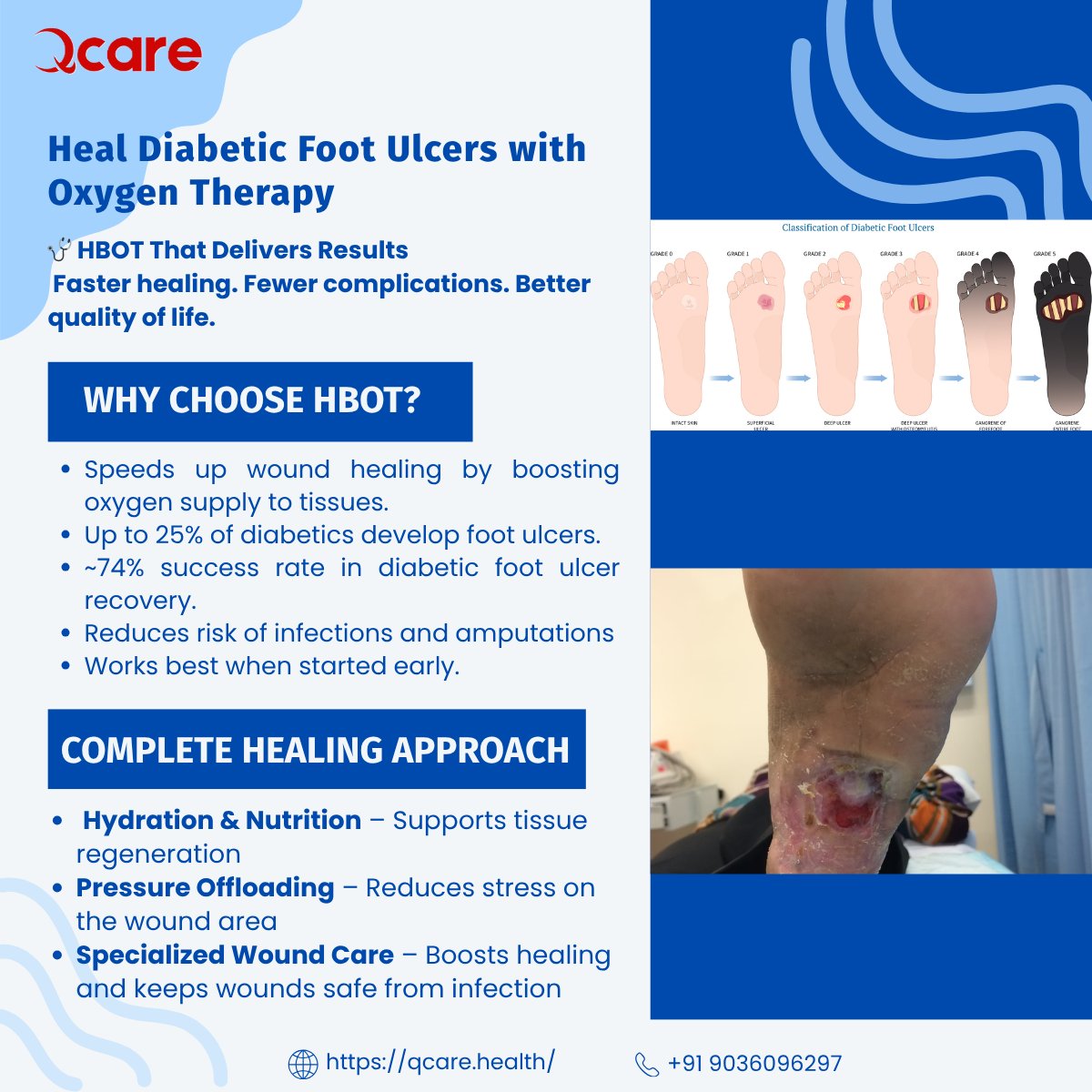 Qcare_Health's tweet photo. Heal diabetic foot ulcers faster with HBOT – oxygen therapy that boosts healing, cuts complications, and uplifts life! 🌿👣 🌐 https://t.co/4uATTwh8LV | 📞 +91 9036096297
#QCARE #HBOT  #HealingJourney #Wellness #HealthFacts #AntiAging #WoundHealing #OxygenTherapy #RecoverySupport https://t.co/JYoYozGzzx