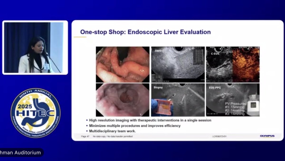 SyedGerdezi's tweet image. 🚀 One-stop shop #EndoHepatology – an excellent start to #HITEC Day 1  to keep me hooked. 

👏 Well done @shaimaa_elkholy &amp;amp; TeamCairo on a superb live case 🔬✨
#Liver #GIEndoscopy 

@MouenKhashab