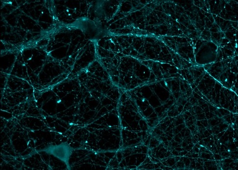 CSIC's tweet image. 🫀🧠Un sensor biológico revela cómo funciona una proteína clave para la #memoria y el #corazón
🦠La herramienta desarrollada por un equipo del #CSIC permite monitorizar la actividad de ‘CaMKII’, una proteína esencial en el aprendizaje y la memoria
➡️tiny.cc/c1dt001