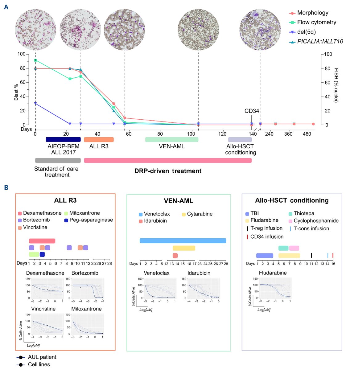 A 6-year-old male diagnosed with acute undifferentiated leukemia was treated with an individualized strategy based on ex vivodrug testing. The future is now.
haematologica.org/article/view/1…