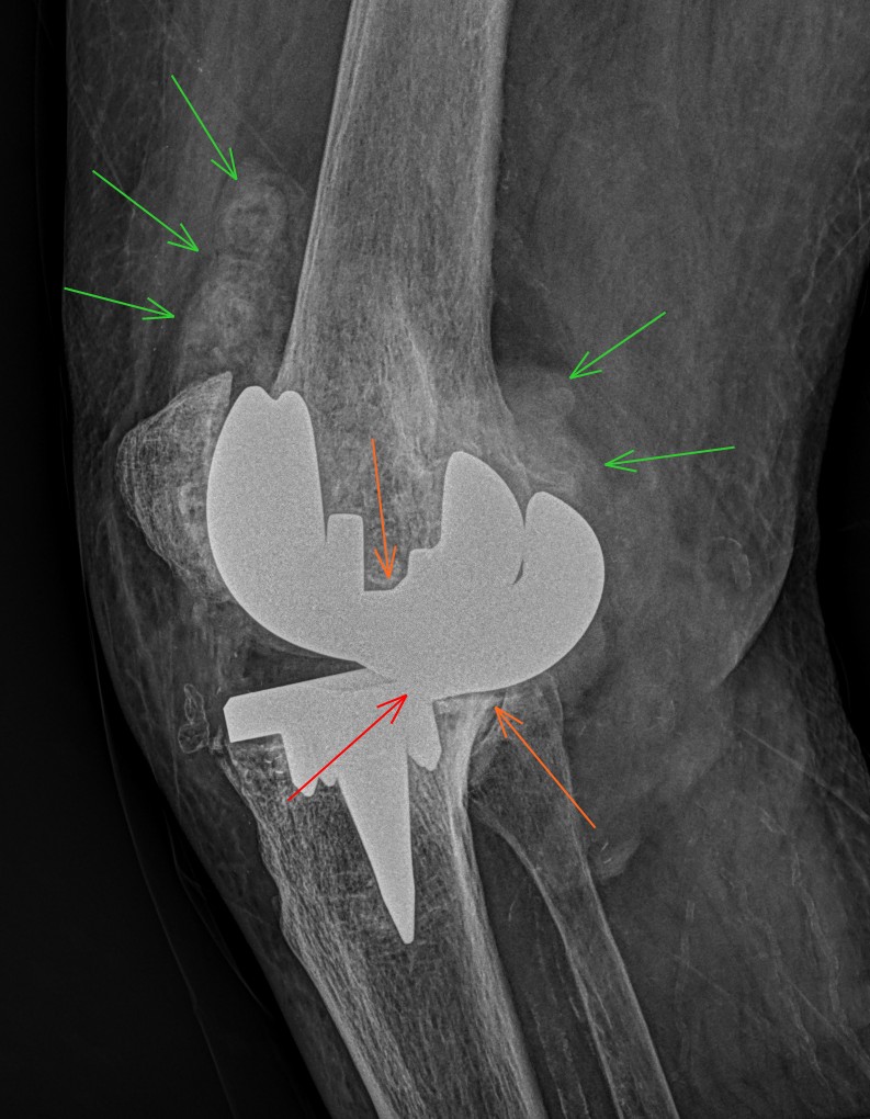 JuanMiranda tweet media