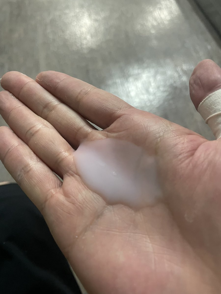 これはクライミング用の液体チョークです。