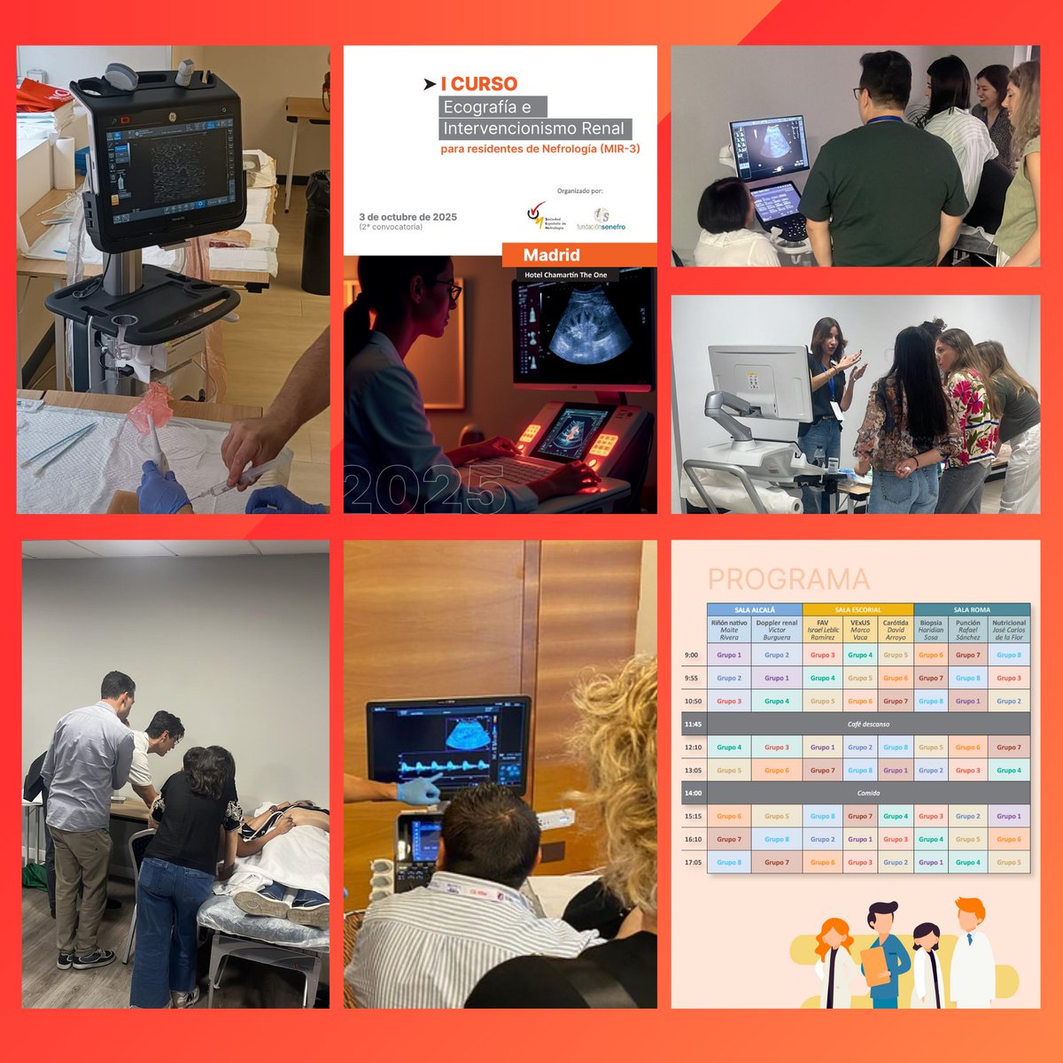 S.E.N. Nefrología (@senefrologia) on Twitter photo 📍Hoy en #FormaciónSenefro.... Comienza la 2ª convocatoria del Curso de Ecografía e Intervencionismo renal para MIR3 nefrología en Madrid.
Gracias a <a href="/AstraZenecaES/">AstraZeneca España</a> <a href="/CSLViforES/">CSL Vifor ES</a> <a href="/CARDIVAGROUP/">CARDIVA</a> PALEX | B.Braun <a href="/AstellasEurope/">Astellas Europe</a>
@GEHealthCare_ES <a href="/philsontech/">PHILSON TECHNOLOGIES</a> <a href="/MindraySpain/">Mindray España</a> por hacerlo 📍Hoy en #FormaciónSenefro.... Comienza la 2ª convocatoria del Curso de Ecografía e Intervencionismo renal para MIR3 nefrología en Madrid.
Gracias a <a href="/AstraZenecaES/">AstraZeneca España</a> <a href="/CSLViforES/">CSL Vifor ES</a> <a href="/CARDIVAGROUP/">CARDIVA</a> PALEX | B.Braun <a href="/AstellasEurope/">Astellas Europe</a>
@GEHealthCare_ES <a href="/philsontech/">PHILSON TECHNOLOGIES</a> <a href="/MindraySpain/">Mindray España</a> por hacerlo