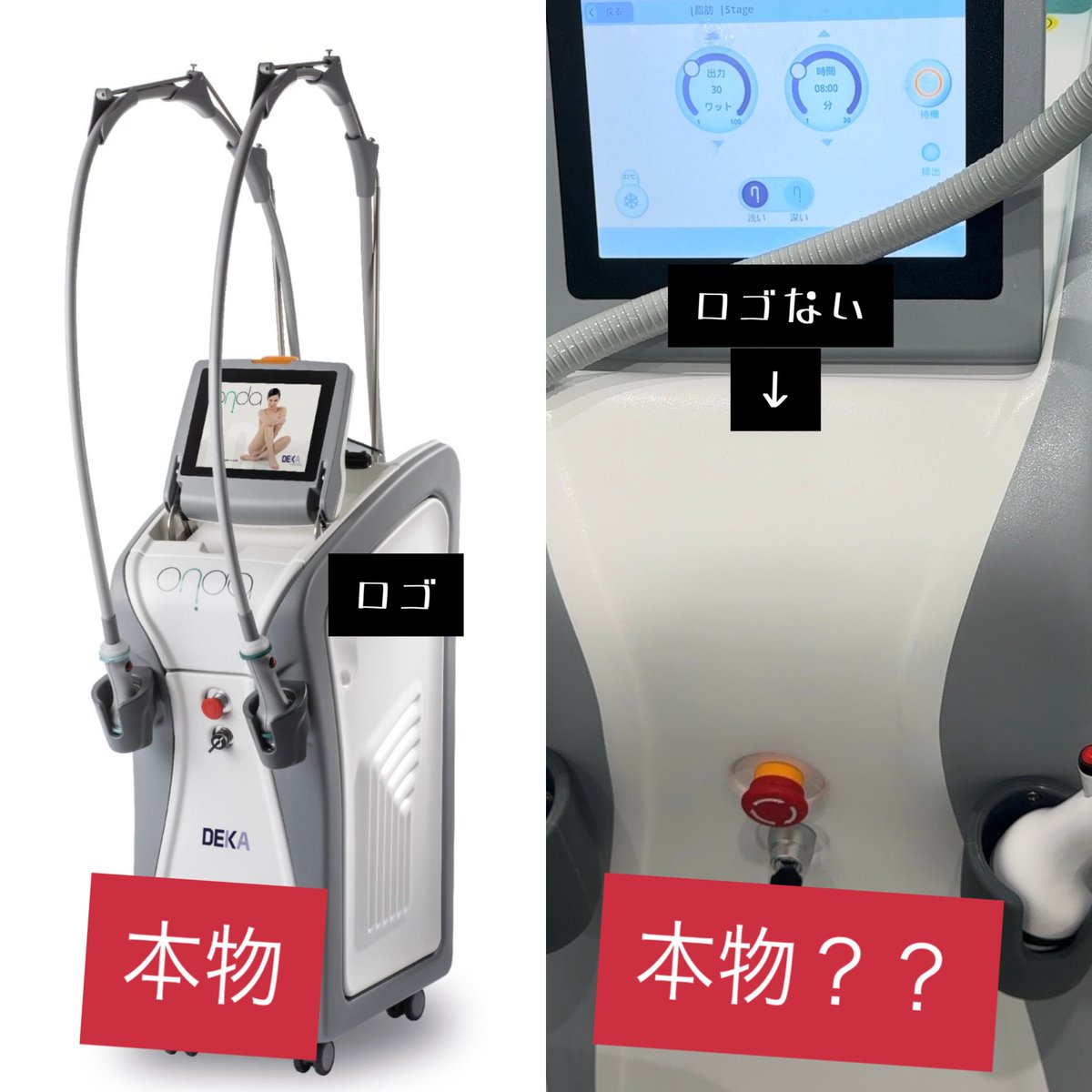 エステ版オンダリフト　オンダプロ オンダリフト（オンダプロ・ONDA Pro） | セレクトクリニック