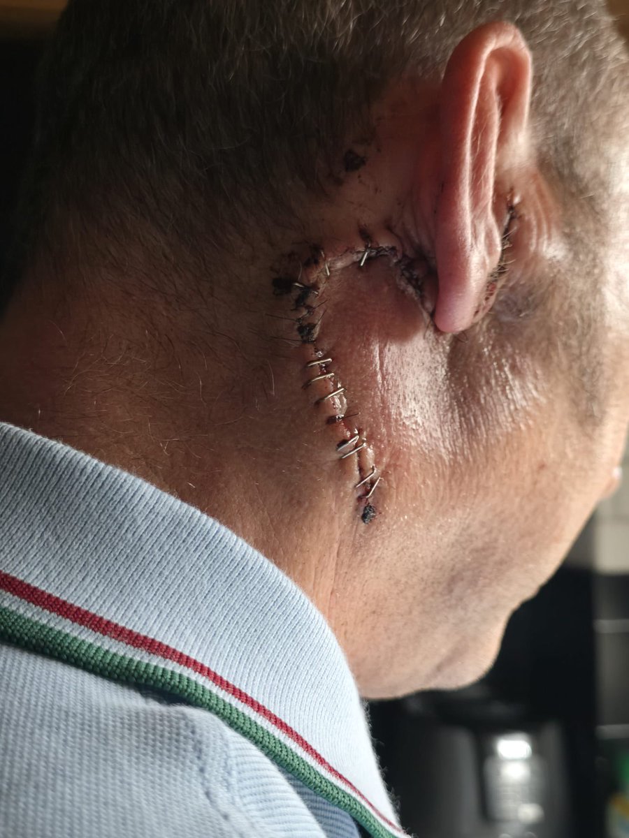 Massive thank you to the nurses at St John’s Hospital Day surgery for looking after me after my operation. Everyone of them went above and beyond to make sure I was comfortable.