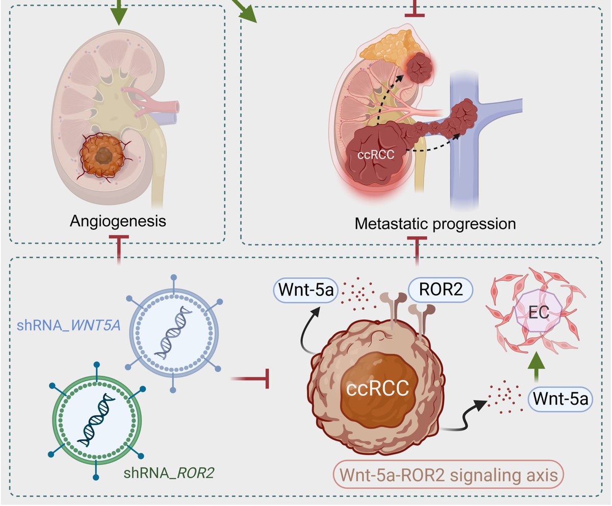 AJPathology's tweet image. #LegacyContent: Wnt-5a–Receptor Tyrosine Kinase-Like Orphan Receptor 2 Signaling Provokes Metastatic Colonization and Angiogenesis in Renal Cell Carcinoma, and the Axis Activation Is Suppressed by Prunetin
Free in the #OpenArchive: ajp.amjpathol.org/article/S0002-…