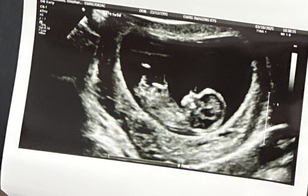 See you soon little wonder ❤️