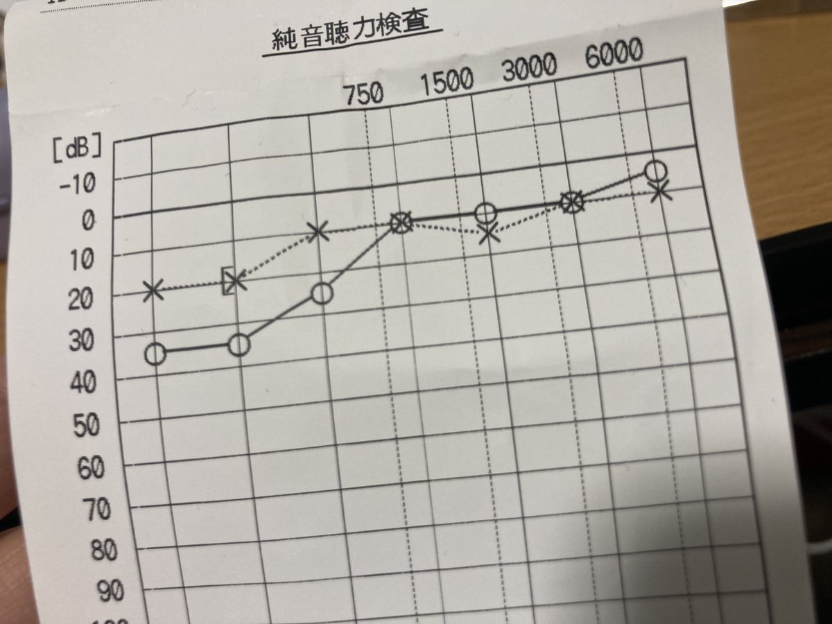 maegami79's tweet photo. 右耳が低音なんとか難聴になって
聴力検査をした結果‥

元々左もしっかり低音カットされてますやんけ！！！
（そして平均的によくない）

もう今まで以上に自分のイコライジングもミキシングも信じられないけどそもそもみんな聴力違うしまあいいやどうでもいいや

…いいの？ https://t.co/yXO61kub2X