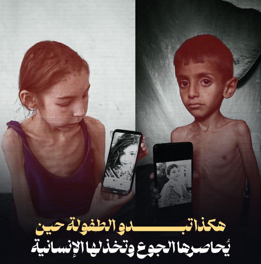 سلاح التجويع.. العالم ينصرف عن معاناة أهل غ زة.. الأمم المتحدة: ما يحدث مذبحة.. ومتحدث أوتشا: نمط مخيف لقتل الحشود من بينهم أطفال للحصول على الغذاء.. ومفوض الأونروا يصف آلية المساعدة الإسرائيلية بفخ الموت