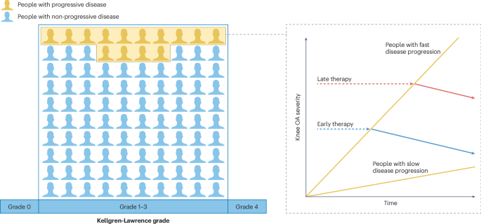 New content online: Novel approaches to the stratified management of knee osteoarthritis bit.ly/42qQDPX
