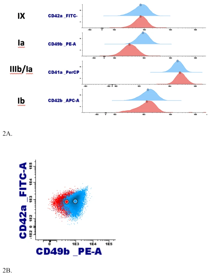 Thrombosis_J's tweet photo. 🚨Article Alert🚨

From Bernard-Soulier syndrome to sitosterolemia: the role of genetic analysis in bleeding diathesis 🧬
#OpenAccess #GeneticAnalysis #ThrombosisResearch

Read the Article: https://t.co/NHgv11m76l https://t.co/OQzTxv8pM6