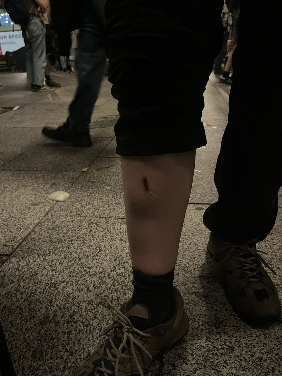 ‼️‼️‼️MOSSOS ataquen desproporcionadament amb rafagues de gas pebre! 

NO US TOQUEU ELS ULLS, NO US FREGUEU LA CARA AMB LA ROBA. Tireu-vos llet, almax i calmants. 

No marxeu soles a casa, hi ha sanitaris a la zona.