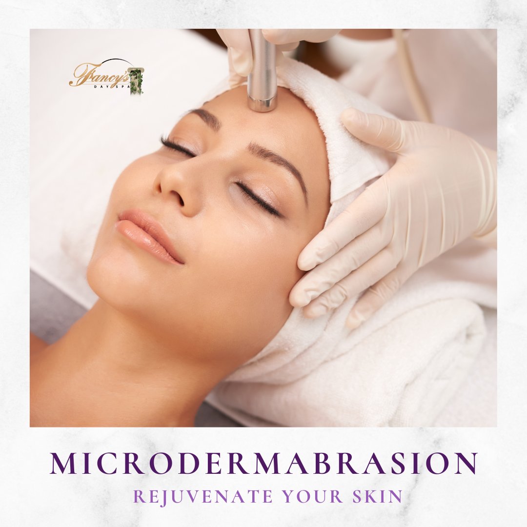 fancysdayspa's tweet image. Smooth fine lines, fade acne scars, and brighten dull skin — microdermabrasion helps your glow show! 💆‍♀️ Book now: https://rfr.bz/t319cf9

#finelines #scars #hyperpigmentation #skincare #facial