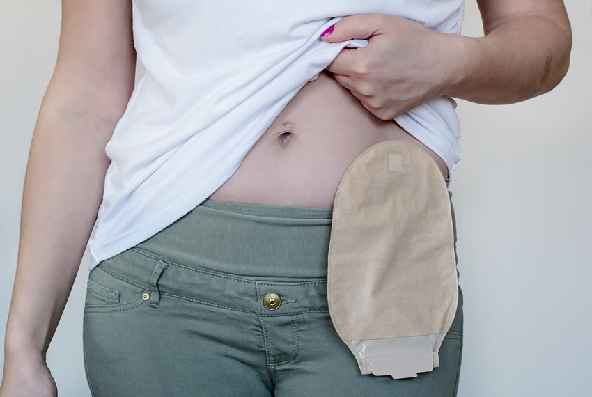 En España, más de 70K personas viven con una ostomía.
Las enfermeras estomaterapeutas son esenciales para su cuidado, autonomía y calidad de vida.
En el #DíaMundialDelPacienteOstomizado, desde el #COEMálaga destacamos su labor.

#colenfermálaga

colenfermalaga.com/contenido/6037…