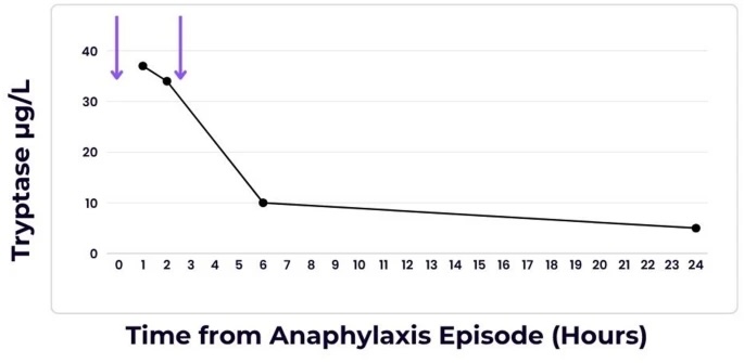 Aller_MD's tweet image. Transient #refractory #period in severe #iodinated #contrast #media #allergy: a case report. Open Access. ivancevichmd.blogspot.com/2025/10/transi…