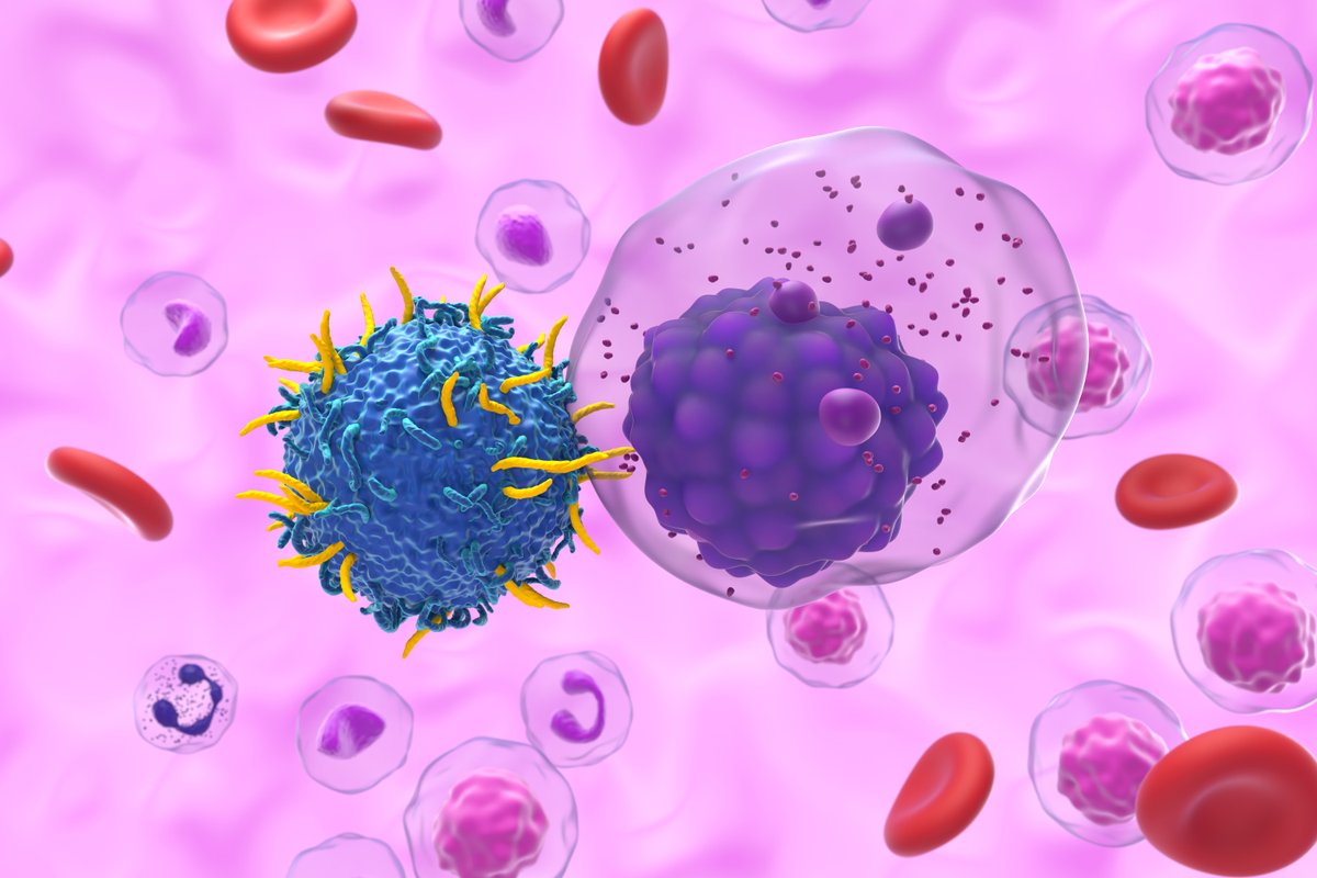 OncNewsCentral's tweet photo. Long-term findings from the FELIX study suggest CAR T-cell therapy with obecabtagene autolecucel can be a definitive treatment for certain patients with relapsed/refractory B-cell acute lymphoblastic leukemia. https://t.co/bEpmpVRZkU
#SOHO25 https://t.co/rDGE554LQC