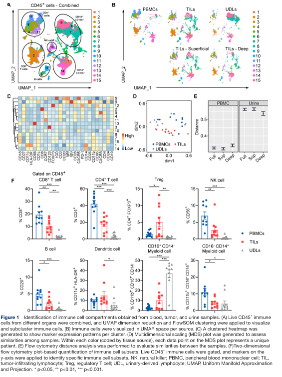 OhioStatePIIO's tweet photo. 🎉 Congrats to Dr. @DebSundi & team on their new @jitcancer publication!

This study shows that urine-derived #lymphocytes (#UDLs) can serve as a non-invasive #biomarker reflecting #tumor_infiltrating_lymphocytes (#TILs) & sex-based #immune differences in #bladder_cancer.

👉 https://t.co/DKUDOTrr5Q

@OSU_Urology @OSUCCC_James