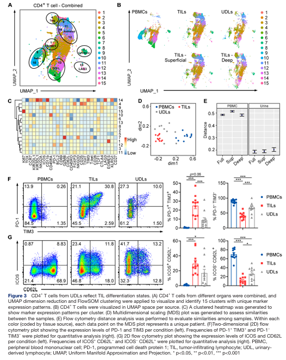 OhioStatePIIO's tweet photo. 🎉 Congrats to Dr. @DebSundi & team on their new @jitcancer publication!

This study shows that urine-derived #lymphocytes (#UDLs) can serve as a non-invasive #biomarker reflecting #tumor_infiltrating_lymphocytes (#TILs) & sex-based #immune differences in #bladder_cancer.

👉 https://t.co/DKUDOTrr5Q

@OSU_Urology @OSUCCC_James