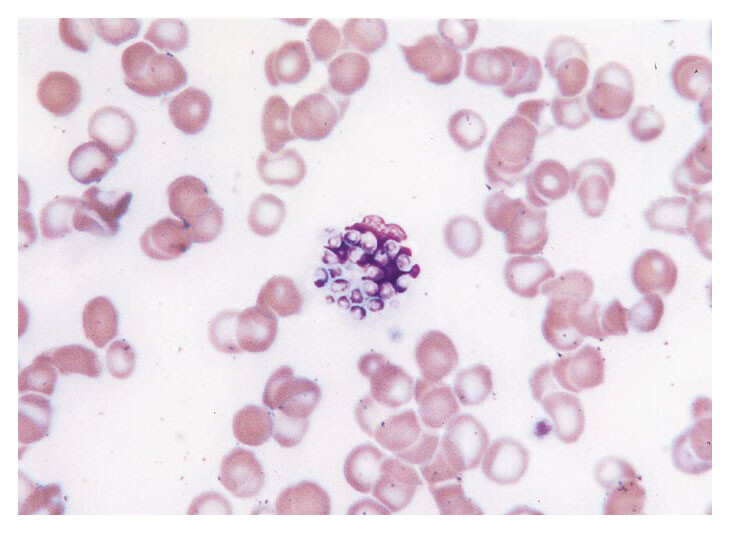 Mayo Clinic Infectious Diseases tweet media