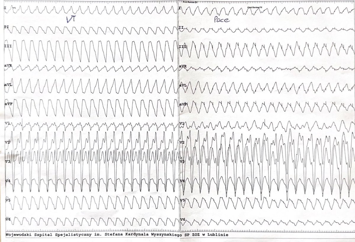 Lublin_EP tweet media