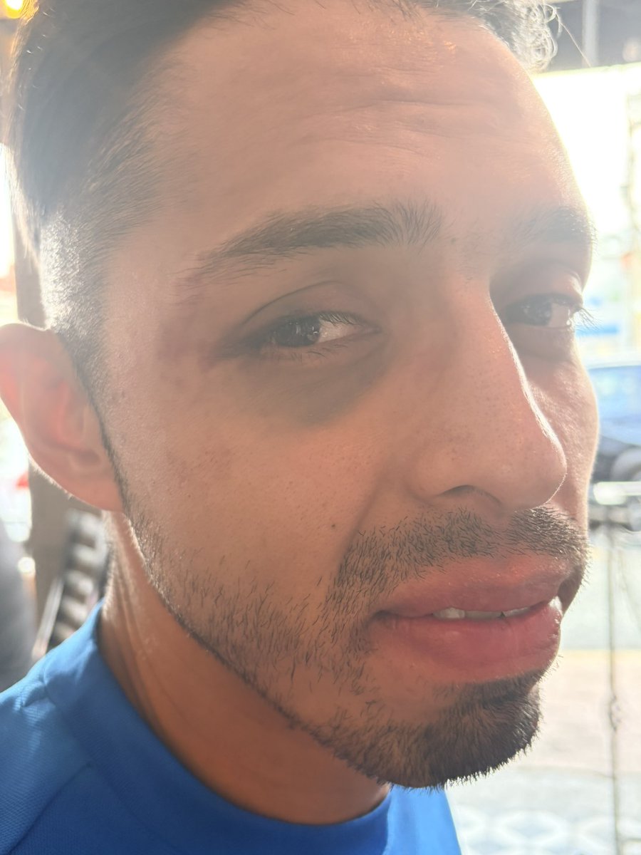 fergarciahe's tweet image. El día de ayer mi primo fue asaltado y agredido por un Didi y un tipo escondido en la cajuela, me dejó y a los dos min empezaron a golpearlo y a despojarlo de todas su pertenencias, así como amedrentarlo para hacer transferencias bancarias (al mismo conductor). @DiDi_Mexico