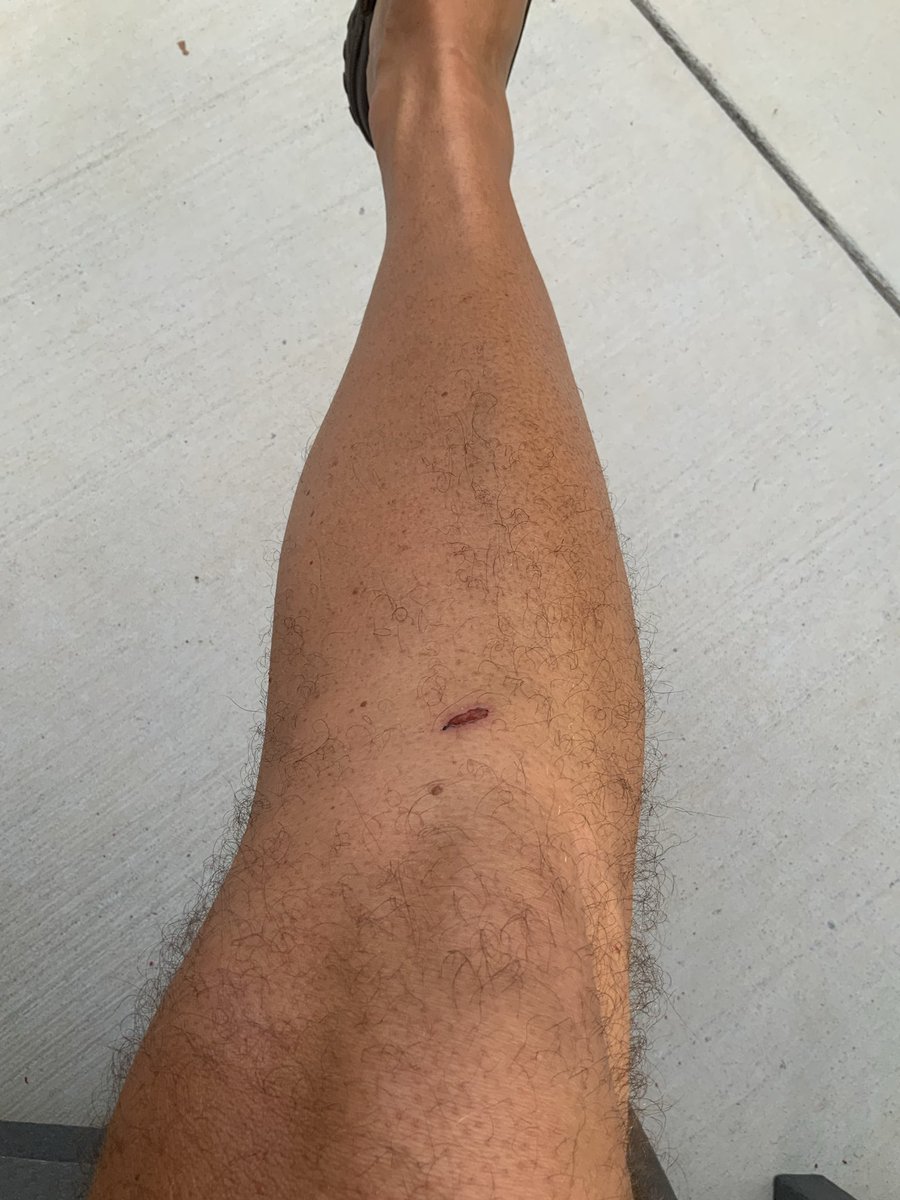 I always find these cuts and I have no idea how I get them.