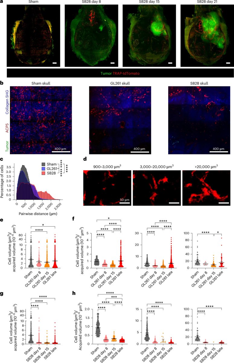 Brain tumors induce widespread disruption of calvarial bone and alteration of skull marrow immune landscape
nature.com/articles/s4159…