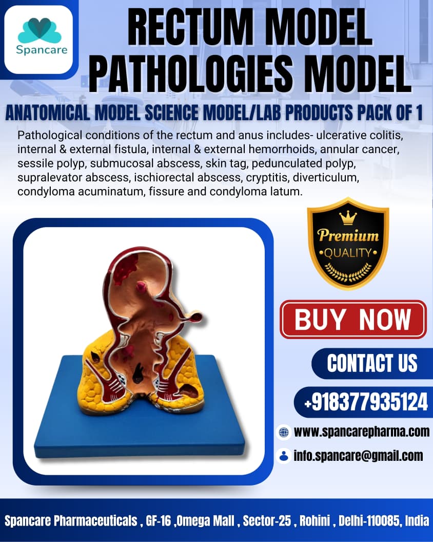 MedicosSaini's tweet image. Buy Rectum Pathologies Anatomical Model – Premium
📞 Contact Us for Orders / Distributor Inquiries:

📲 +91 83779 35124
🌐 spancarepharma.com
 info.spancare@gmail.com

#RectumModel #AnatomicalModel #MedicalTraining #MedicalEducation #MedicalSupplies #MedicalExport