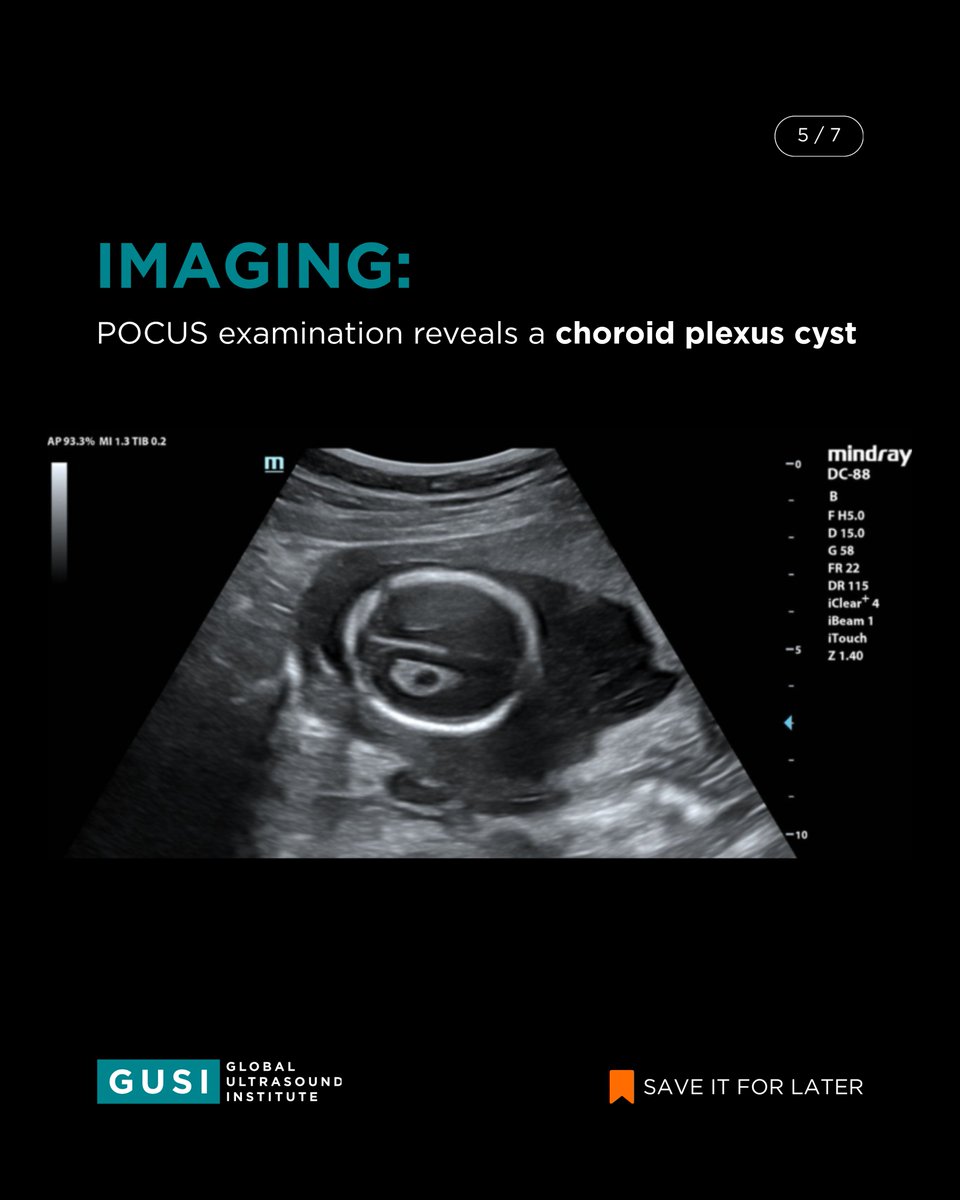 Global Ultrasound Institute tweet media