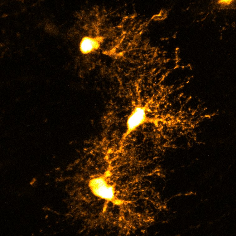 New cell-type for #FluorescenceFriday : a collection of astrocytes in the cerebral cortex