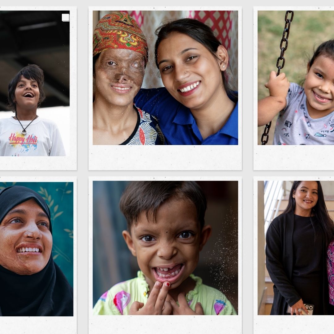 ReSurge's tweet image. Smiles are contagious 👩‍⚕️ 

When we heal a burn, repair a cleft, help a patient regain function, or feel comfortable in their own skin — they smile, their family smiles, our supporters smile, you smile, and we smile.

Happy World Smile Day 🙂 🙃  #WorldSmileDay
