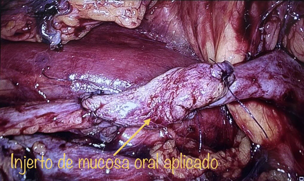 dr_blas's tweet photo. https://t.co/TDpK0ry6Hr