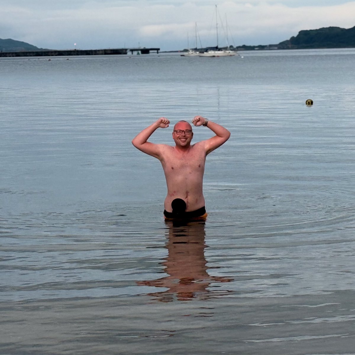 stevensharp90's tweet image. World Ostomy Day 

A day to raise awareness and show support.

My stoma saved my life it’s the reason I’m still here, doing what I love and trying to make a difference every day. It’s not always easy but I’m so grateful for the opportunity it gave me.