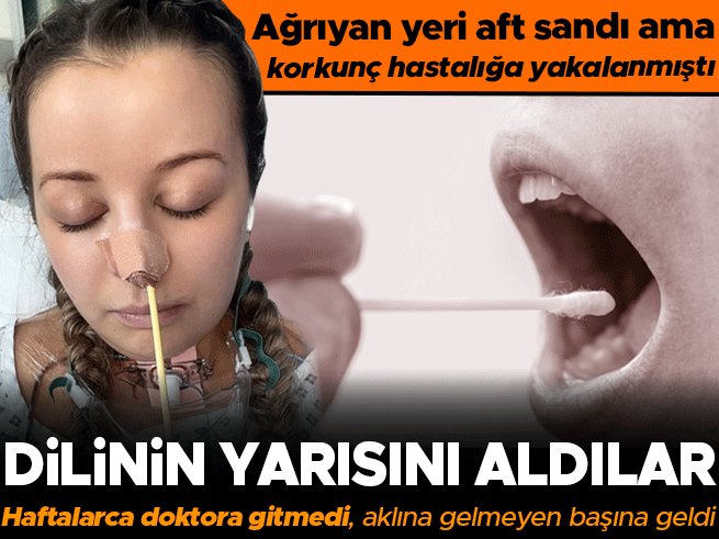 Ağzının içinde başlayan ağrıyı aft sanarak pek önemsemeyen bir kadın, haftalar sonra hala iyileşmediğini görünce eczaneye ilaç almaya gitti. Eczacının yönlendirmesiyle doktora giden genç kadın, korkunç bir hastalığa yakalandığını öğrendi.

hurriyet.com.tr/aile/agriyan-y…