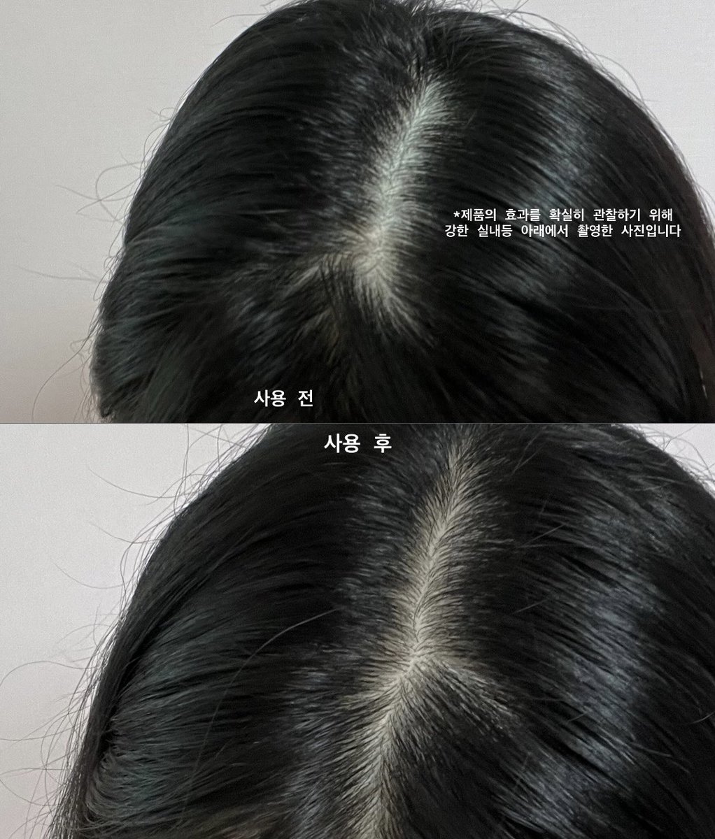 wondimeku's tweet photo. #제품제공 #RT이벤트 
이 글을 RT해주신 분 중 5분을 추첨하여 “닥터포 헤어 정수리 탈모 앰플 본품“을 보내드립니다!

❤️올리브영 런칭 특가❤️
39000원>27900원(28% 할인) (10.1~10.7)
10월 한 달간 기획 세트 구매 시 두피 괄사 키링(귀여움)도 100% 증정이래요!

이번에 닥터포헤어에서 정수리 탈모 앰플이 출시되었는데요! 9월 초부터 샘플을 받아 사용해 보았어요🥰
사진과 함께 대략 3주 간의 후기를 타래로 잇겠습니다!