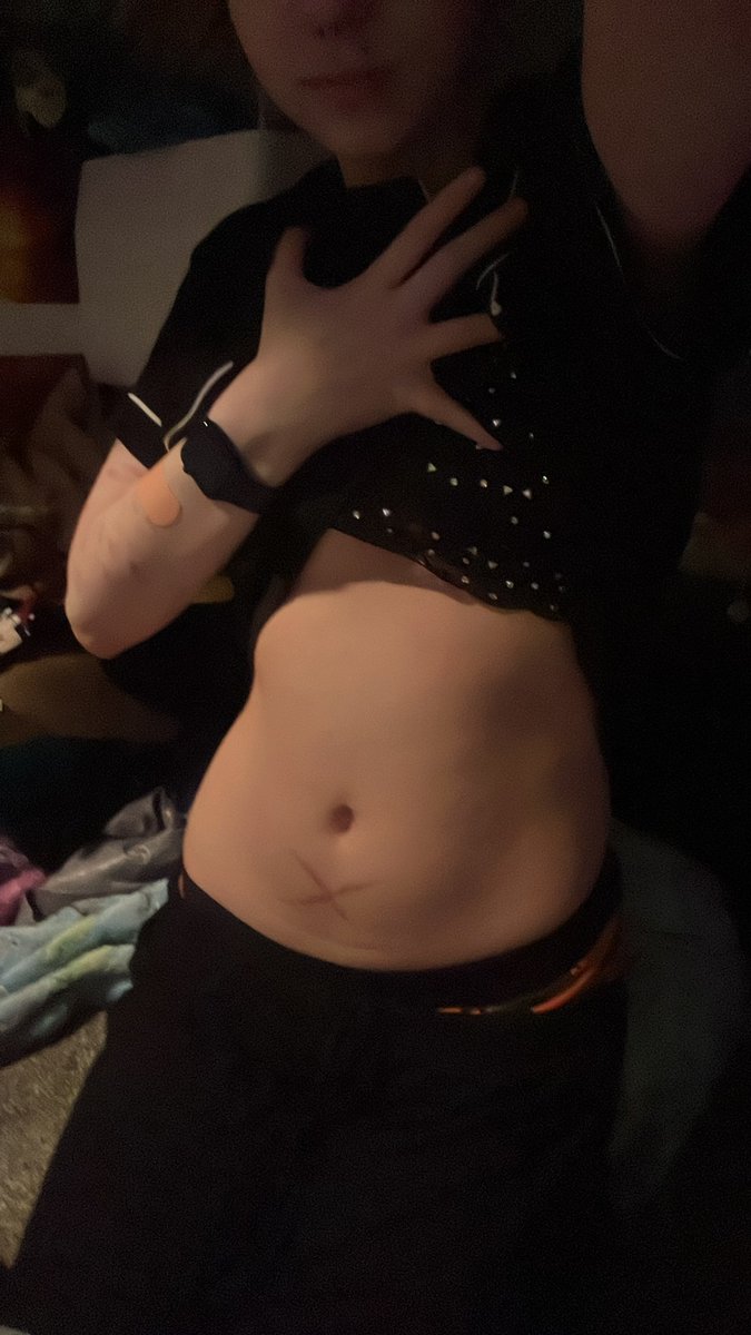 CW: Irl

Oh eww that's so gross what idiot would cut there...
/s