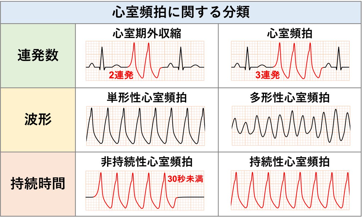 心室頻拍に関する分類