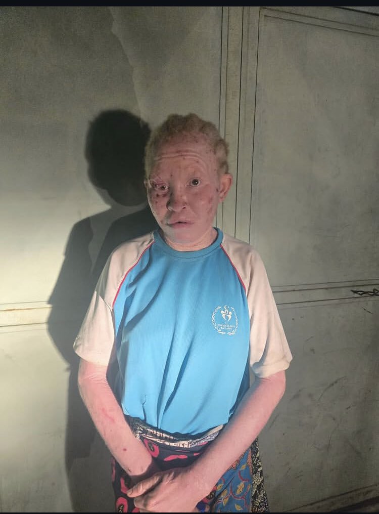 GangMilly01's tweet image. 🔴Voici &quot;Morgane&quot; la femme kuluna la plus recherché de du Congo Brazzaville 🇨🇬 , qui vient d&apos;être attrapé par la #DGSP ce soir dans une des ces cachettes au quartier Jacques opango (Brazzaville).