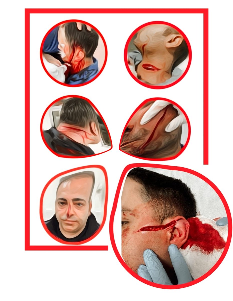 Bir İnfaz Koruma Memuru daha saldırıya uğramasın!

Adaletin teminatı olan bu insanlar, her gün hayatlarını ortaya koyuyor.

Artık yeter!

#CezaevineGüvenlik