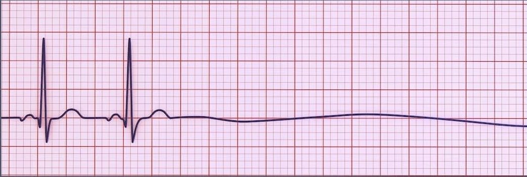 I knew this chart looked familiar