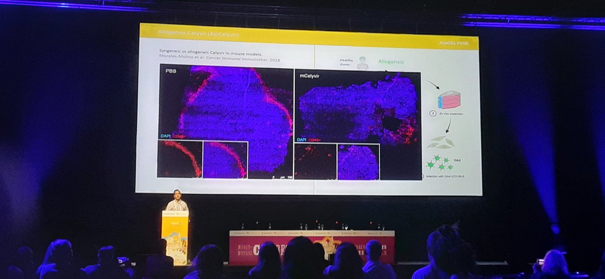oc

At ESGCT 2025, <a href="/Fesisisimo/">Alvaro Morales</a> presented our results from a clinical trial of ALOCELYVIR in children with brain tumors, in a strong collaboration with Dr Álvaro Lassaletta and his team at Hospital Niño Jesús.

<a href="/APUpablougarte/">APU Pablo Ugarte</a> <a href="/AFANION_/">AFANION</a> 
<a href="/SaludISCIII/">Instituto de Salud Carlos III (ISCIII)</a>