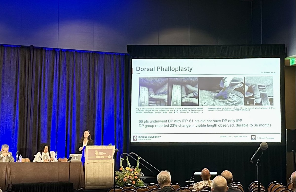 Dorsal phalloplasty accompanying #penileprosthesis implantation minimizes penile shortening and improves patient satisfaction. <a href="/SMSNA_ORG/">SMSNA</a> #smsna25 goes on with presentation of <a href="/drhelenbernie/">Helen L. Bernie</a> 

For  <a href="/yoursexmedjour/">IJIR: Your Sexual Medicine Journal</a> paper 👉 rdcu.be/eKwSk

<a href="/DrOsamaShaeer/">أ.د أسامة شعير</a> <a href="/CairoUniv/">Cairo University</a>
