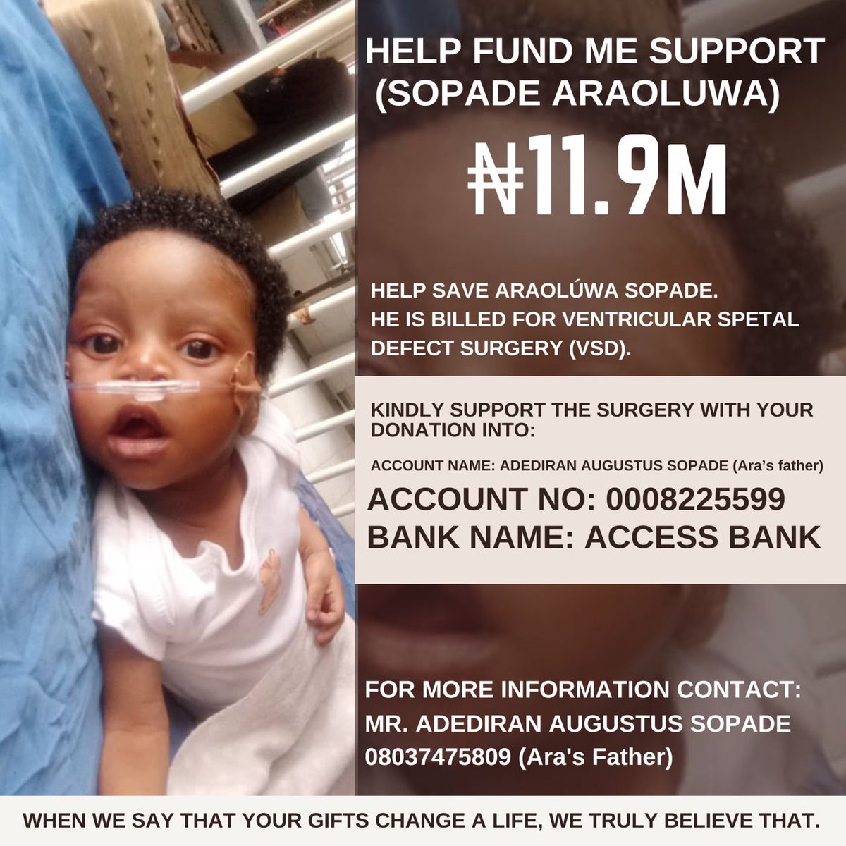 aojjustaoj's tweet image. The family of four-month-old Araoluwa Sopade has appealed to members of the public for financial assistance to enable their infant son to undergo an urgent heart surgery at the Babcock University Teaching Hospital, Ilishan-Remo, Ogun State.

Araoluwa has been diagnosed with a…