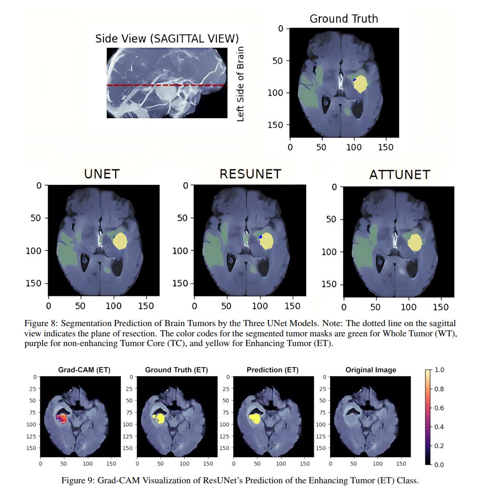 morris_phd's tweet image. Demystifying Deep Learning-based Brain Tumor Segmentation with 3D UNe..
arxiv.org/abs/2510.07785
---
Newsletter morrislee1234.wixsite.com/website/contact
More story morrislee1234.wixsite.com/website
LinkedIn cutt.ly/MorrisLinkedIn
#AINewsClips #AI #ML #ArtificialIntelligence #MachineLearning #ComputerVision